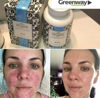 Откажись от химии на всю жизнь  - Изображение #2, Объявление #1700245